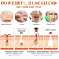 6-in-1 Multi-Function Derma Suction Facial Cleanser