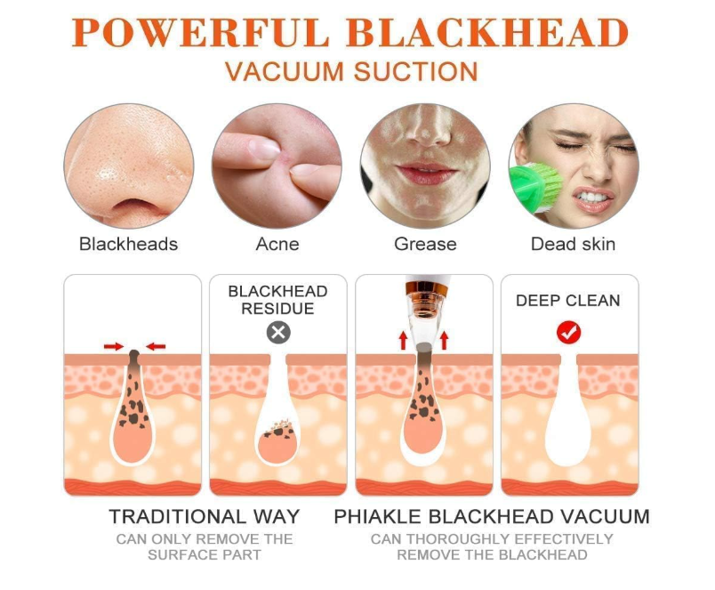 6 in 1 Multi-function Blackhead Remover Tools | Electric Derma suction Machine | USB Rechargeable Acne Pimple Pore Cleaner Vacuum tool - Facial Cleanser Device for Nose & Skin Care (6 in 1 Derma Suction)